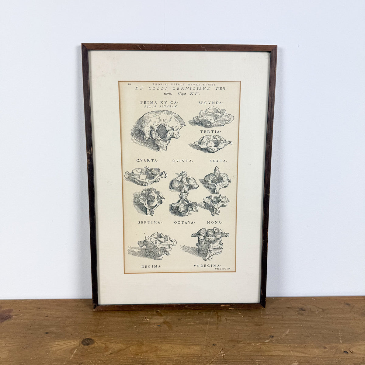 Vintage ingelijste anatomische illustratie van halswervels