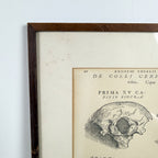 Vintage ingelijste anatomische illustratie van halswervels