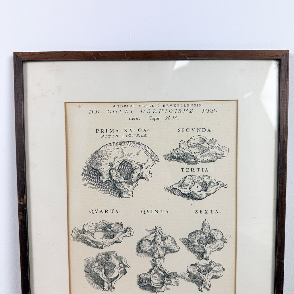 Vintage ingelijste anatomische illustratie van halswervels