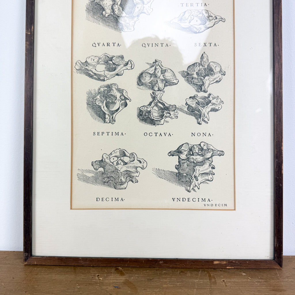 Vintage ingelijste anatomische illustratie van halswervels
