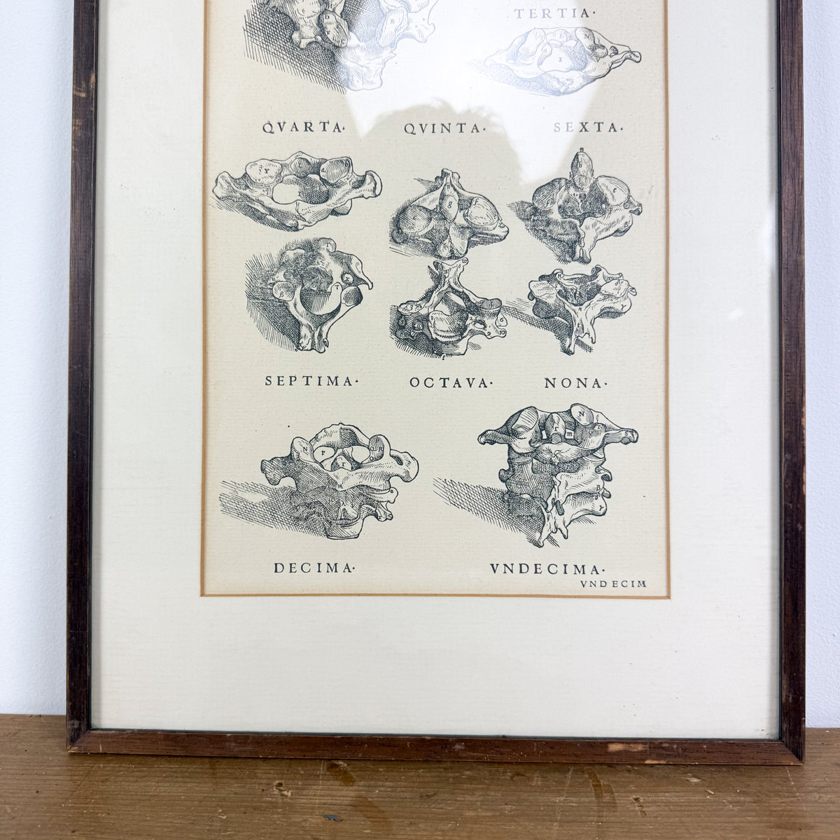 Vintage ingelijste anatomische illustratie van halswervels