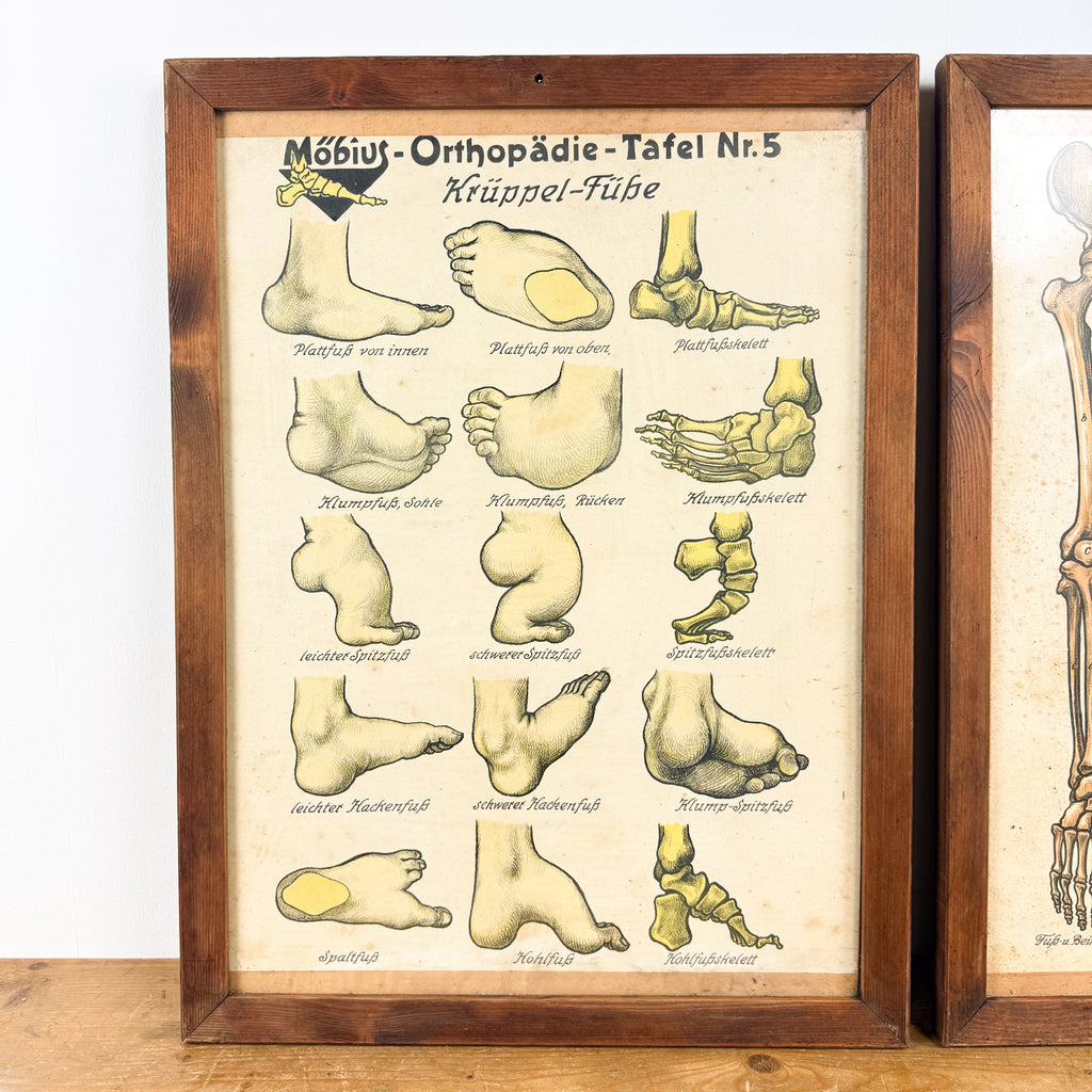 Set van 2 vintage Duitse anatomische orthopedische voetposters