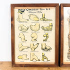 Set van 2 vintage Duitse anatomische orthopedische voetposters