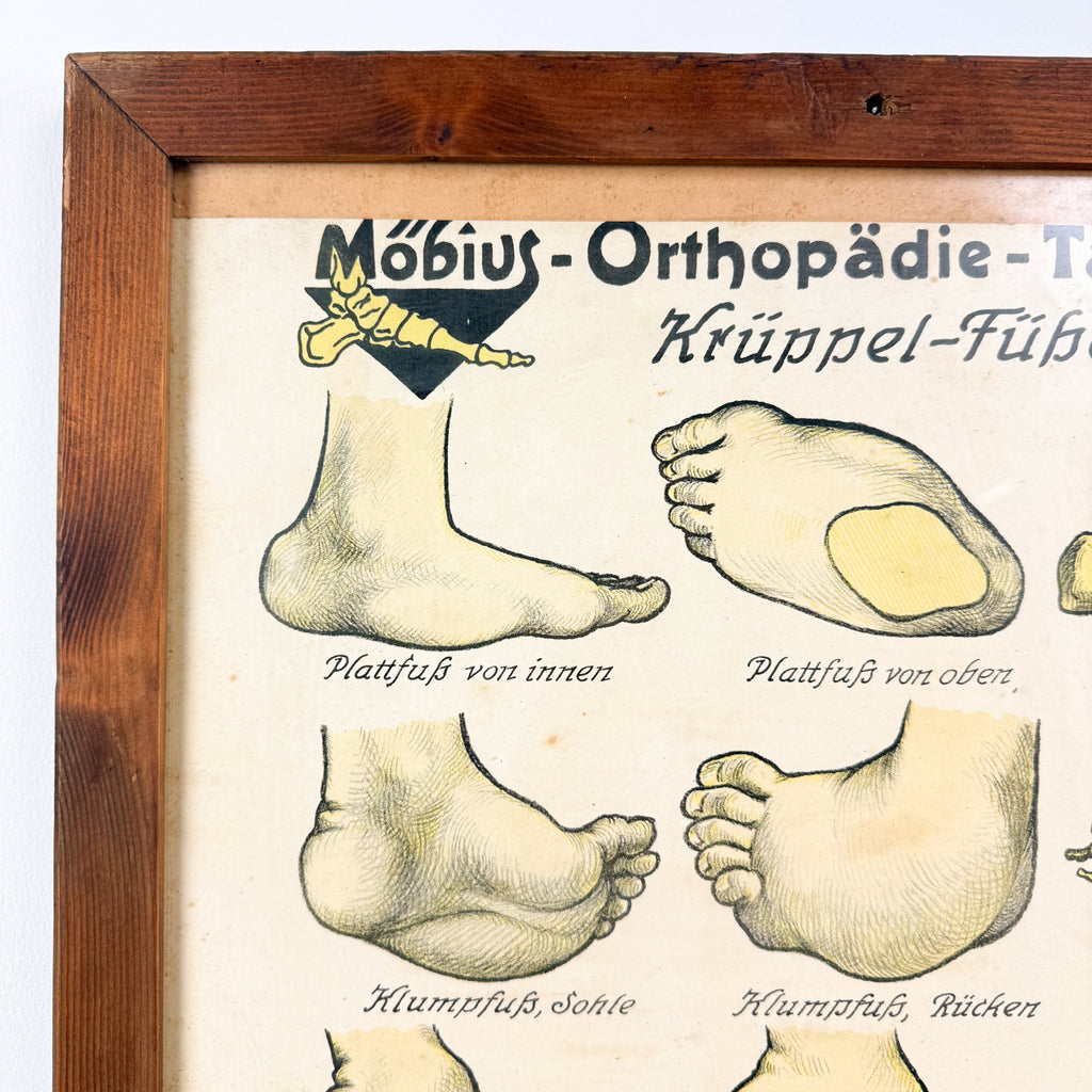 Set van 2 vintage Duitse anatomische orthopedische voetposters