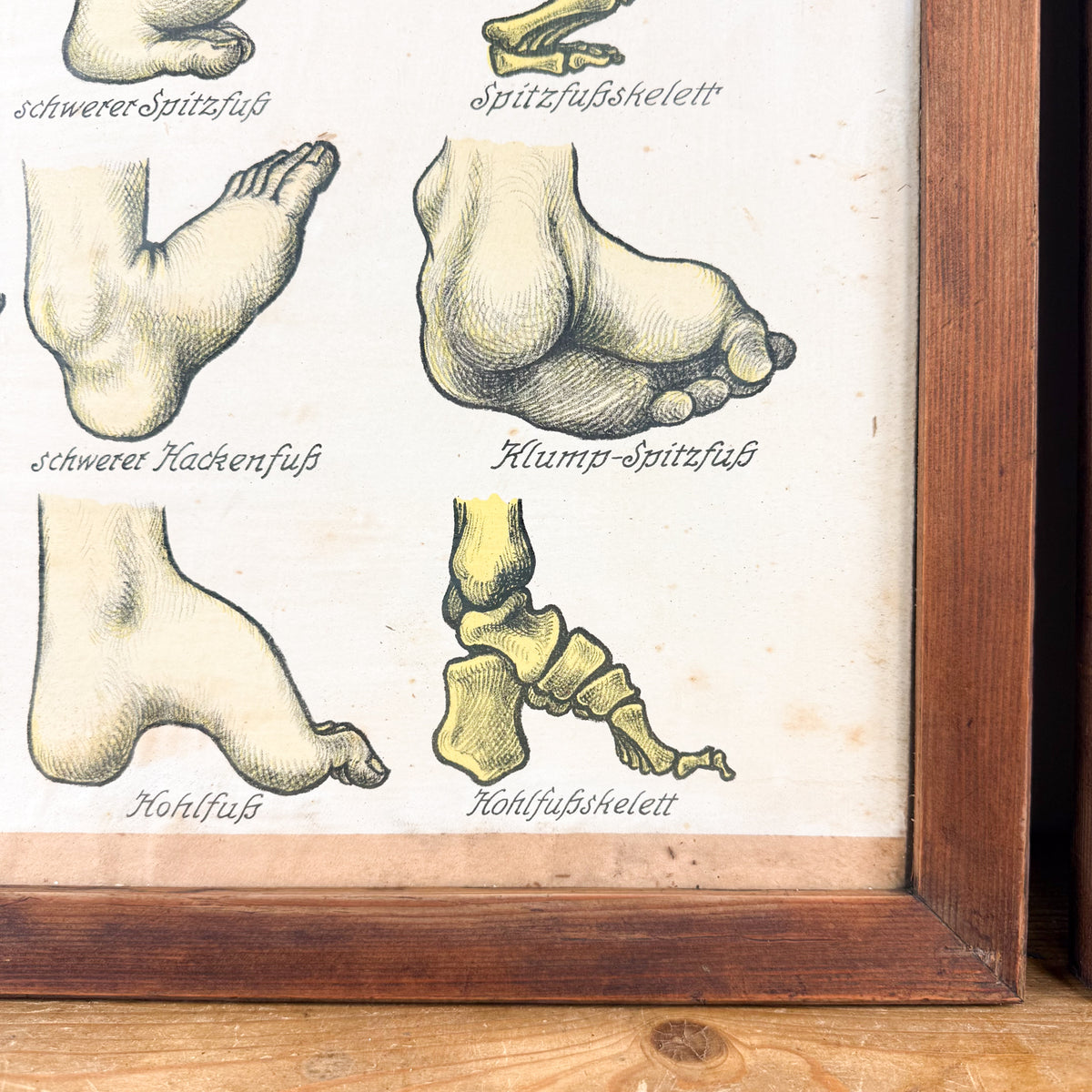 Set van 2 vintage Duitse anatomische orthopedische voetposters