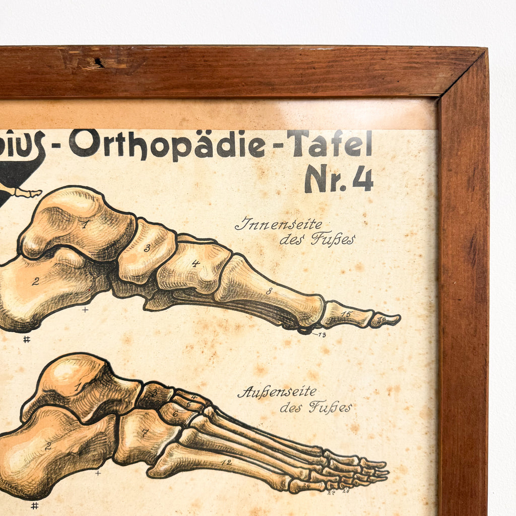 Set van 2 vintage Duitse anatomische orthopedische voetposters