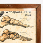 Set van 2 vintage Duitse anatomische orthopedische voetposters